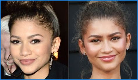 Unveiling The Truth: Zendaya's Plastic Surgery Journey
